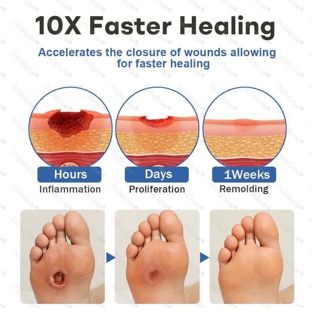 Shifakoon foot care Spray