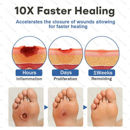 Shifakoon foot care Spray