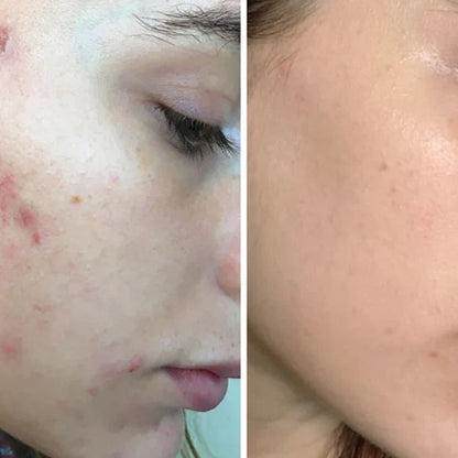 Laniska Scar Soothing Cream | 7-in-1 Skin Repair with Argan Oil, Shea Butter, Vitamin E & Hyaluronic Acid | Fades Scars, Warts & Scratches, Deep Hydration