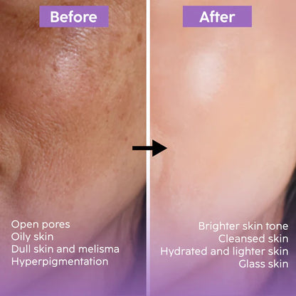 Aroma Magic 7-Step Bridal Glow Facial Kit | Instant Radiance, Skin Brightening & Deep Hydration