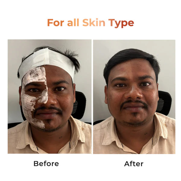 Niconi Tan Vanish Gluta-Kojic Skin Polish 180g