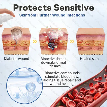 Shifakoon foot care Spray