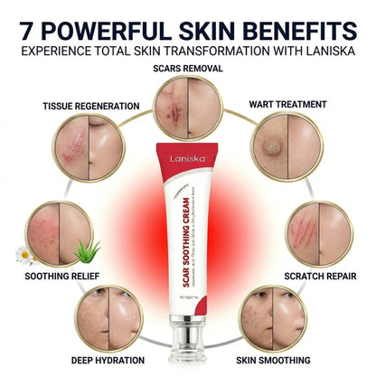 Laniska Scar Soothing Cream | 7-in-1 Skin Repair with Argan Oil, Shea Butter, Vitamin E & Hyaluronic Acid | Fades Scars, Warts & Scratches, Deep Hydration
