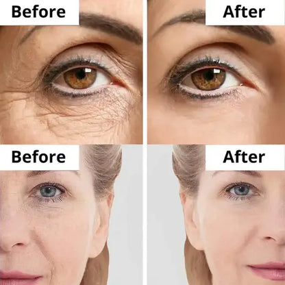 Time Reverse Madeca Cream | Anti-Aging & Skin Revitalization | Pharmaceutical-Grade TECA