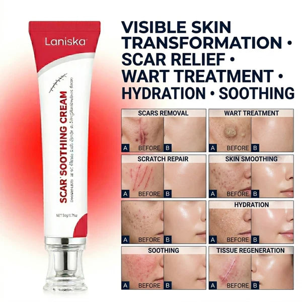 Laniska Scar Soothing Cream | 7-in-1 Skin Repair with Argan Oil, Shea Butter, Vitamin E & Hyaluronic Acid | Fades Scars, Warts & Scratches, Deep Hydration