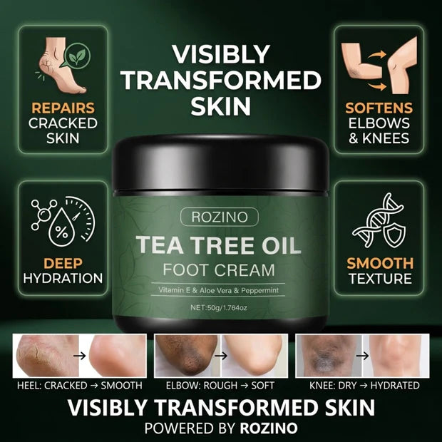 Rozino Tea Tree Oil Foot Cream | Vitamin E, Aloe Vera & Peppermint | Repairs Cracked Heels, Rough Elbows & Dry Knees | Intense Hydration