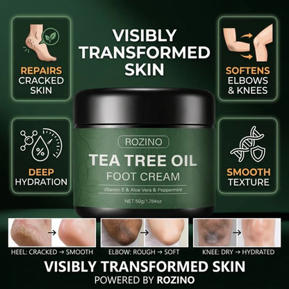 Rozino Tea Tree Oil Foot Cream | Vitamin E, Aloe Vera & Peppermint | Repairs Cracked Heels, Rough Elbows & Dry Knees | Intense Hydration