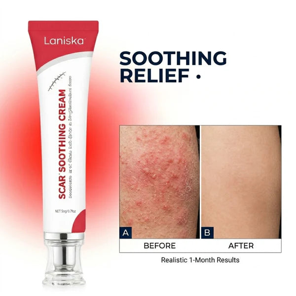 Laniska Scar Soothing Cream | 7-in-1 Skin Repair with Argan Oil, Shea Butter, Vitamin E & Hyaluronic Acid | Fades Scars, Warts & Scratches, Deep Hydration