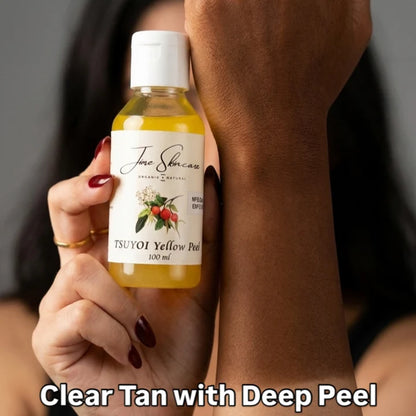 Jiore Tsuyoi Yellow Peel Body Oil | Organic & Natural with Kojic Acid, Turmeric, Thiotic Acid & AHA/BHA | Fades Stretch Marks, Peels Sun Tan & Brightens Skin