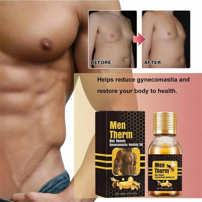 Men Gynecomastia Heating Oil