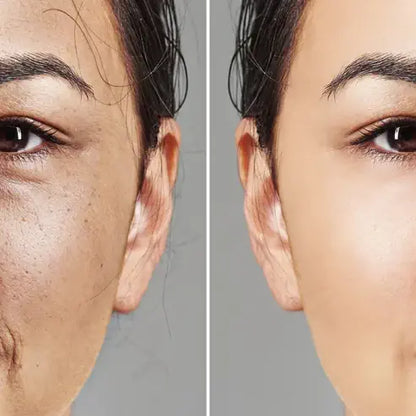 Time Reverse Madeca Cream | Anti-Aging & Skin Revitalization | Pharmaceutical-Grade TECA