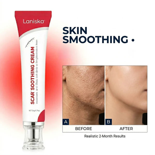 Laniska Scar Soothing Cream | 7-in-1 Skin Repair with Argan Oil, Shea Butter, Vitamin E & Hyaluronic Acid | Fades Scars, Warts & Scratches, Deep Hydration