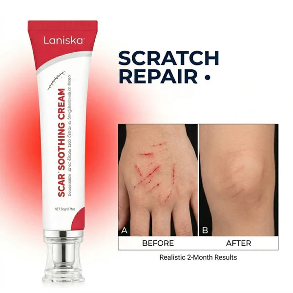 Laniska Scar Soothing Cream | 7-in-1 Skin Repair with Argan Oil, Shea Butter, Vitamin E & Hyaluronic Acid | Fades Scars, Warts & Scratches, Deep Hydration