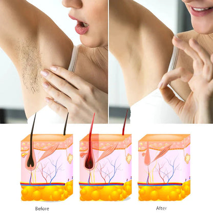 Yardlie Professional Hair Removal Spray