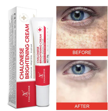 Chalonese brightening cream